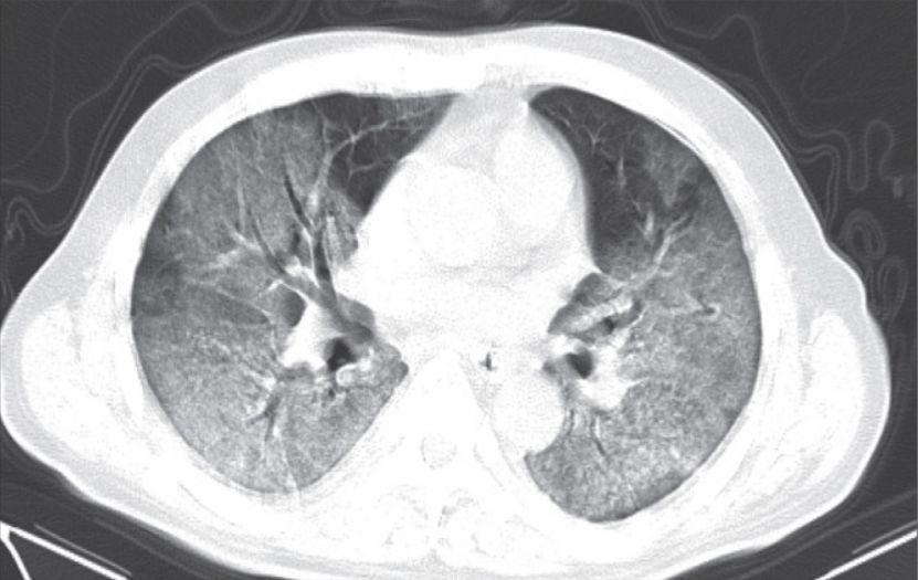 新冠肺炎最新治疗药物,曙光初现的希望之光